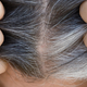 Vzrok sivih las so lahko "zataknjene" celice, pravijo znanstveniki