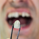 Slabo ustno zdravje povezali z resno spremembo v možganih